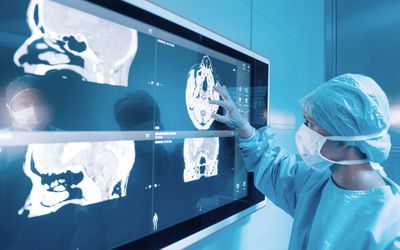 外科医生在看核磁共振扫描。