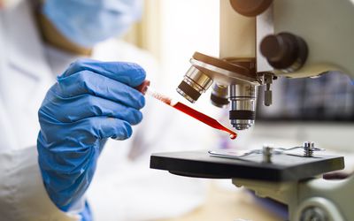 使用眼部滴管的被掩没的人的手套的手在显微镜下