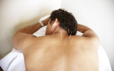 Acupuncture on man's back