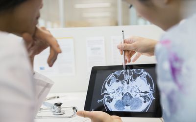 研究人员对大脑扫描