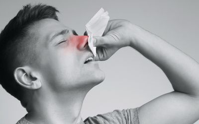 一名年轻人正遭受鼻血之苦