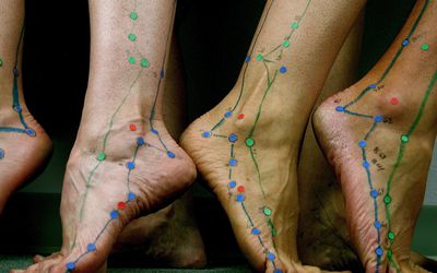 Acupuncture points on feet.