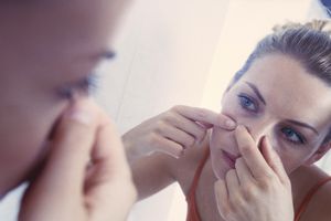 Woman squeezing pimple