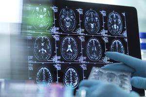 年代cientist looking at brain scans