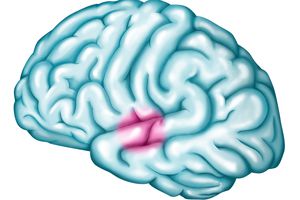 韦尼克区域的插图