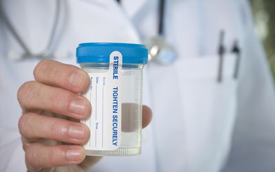 尿杯一种用于检测药物的样品的尿杯